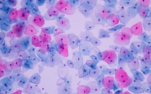 Online Cytology for Trainee Colposcopists Course