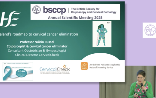 The elimination of cervical cancer - Update from Ireland