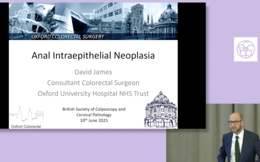 Anal Intraepithelial Neoplasia