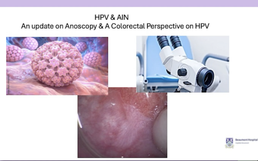 HPV and AIN - An Update on Anoscopy and A Colorectal Perspective on HPV