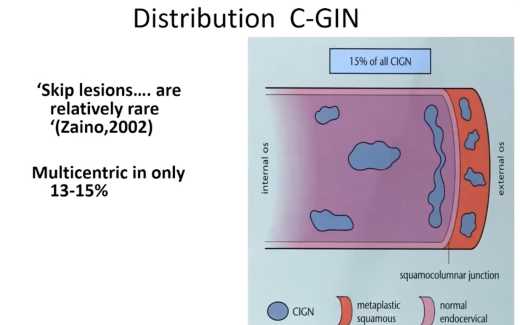 The management of women with Glandular Abnormalities