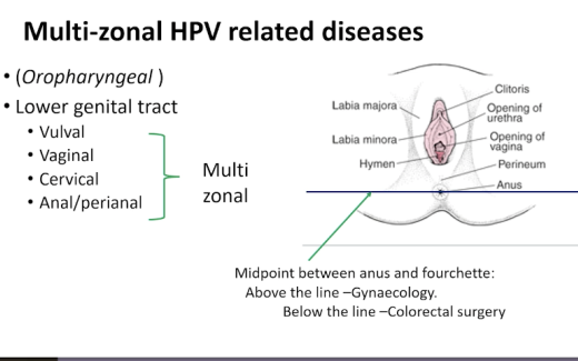 What's New In Multizonal Disease?