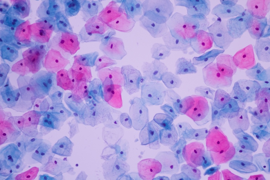 Online Cytology for Trainee Colposcopists Course