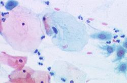Normal Smear